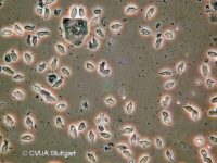 Trichomonaden unter dem Mikroskop